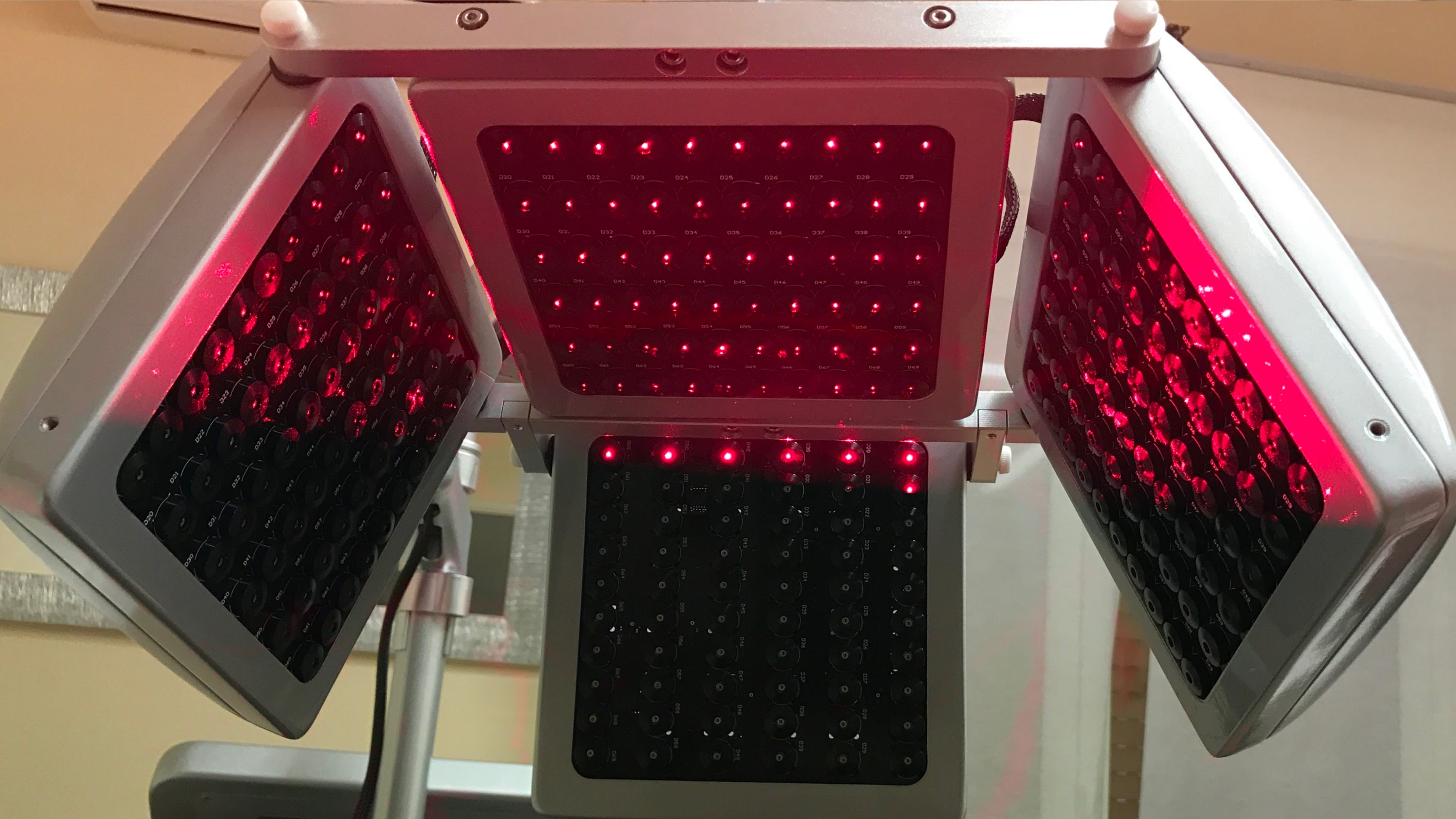 La perdita dei capelli: un vero shock per chi ne soffre, che entrambe i sessi, e può presentarsi in modi diversi, come il diradamento e l’alopecia