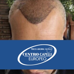 trapianto fue - dopo testimonianza