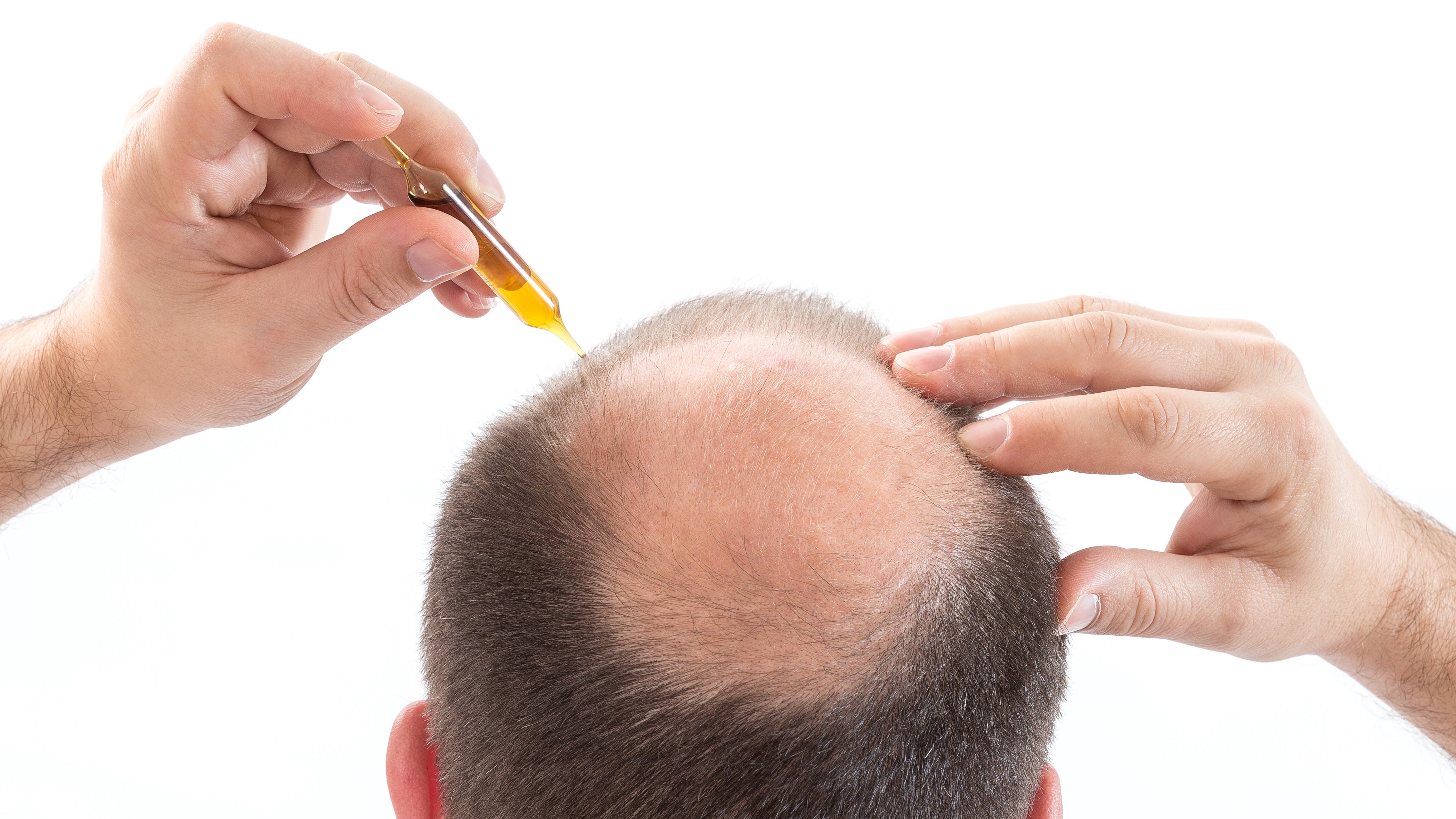 Выпадение волос у мужчин лечение. Рост волос на голове у мужчин. Обои на рост волос на голове. Мужское средство от выпадения волос. Сортировка волос.