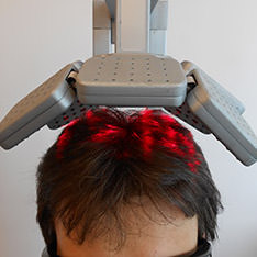 laserterapia capelli