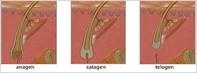 stato del bulbo pilifero