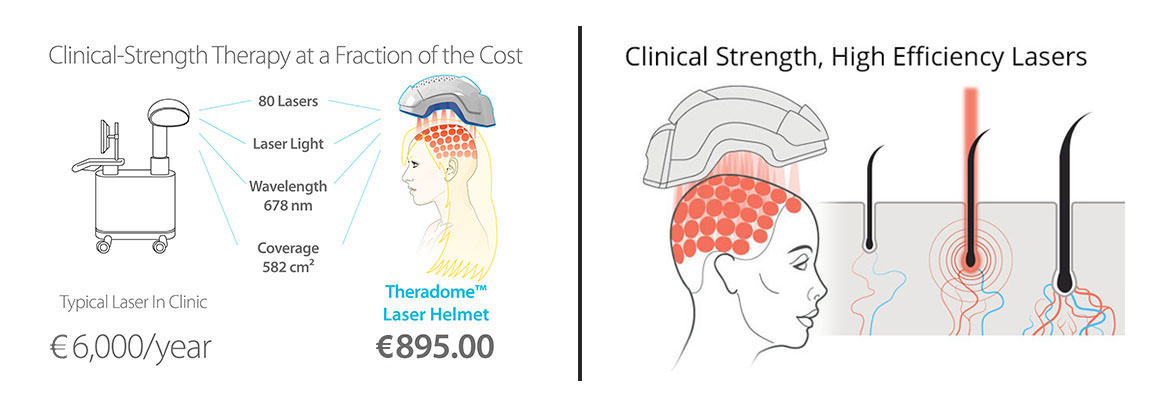 theradome casco laser per crescita capelli