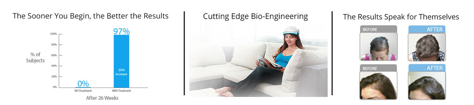 statistiche crescita capelli theradome