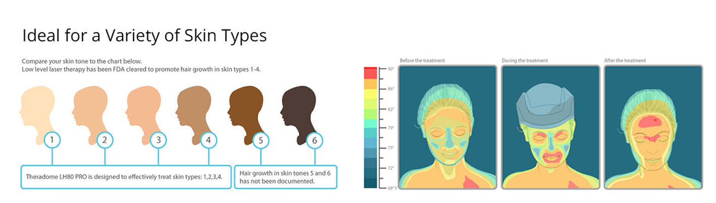theradome per tutti i tipi di pazienti